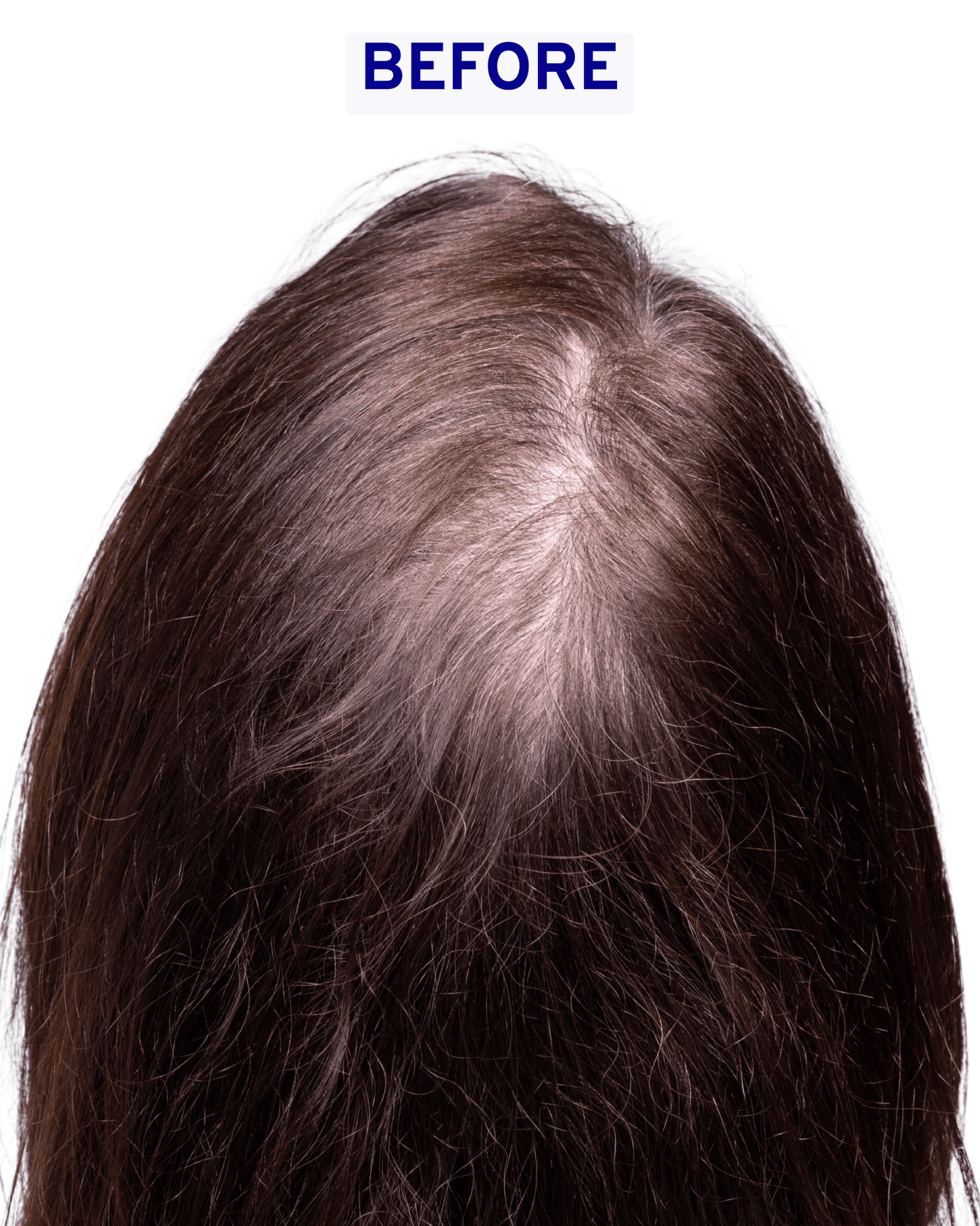 Hair & Scalp Serum