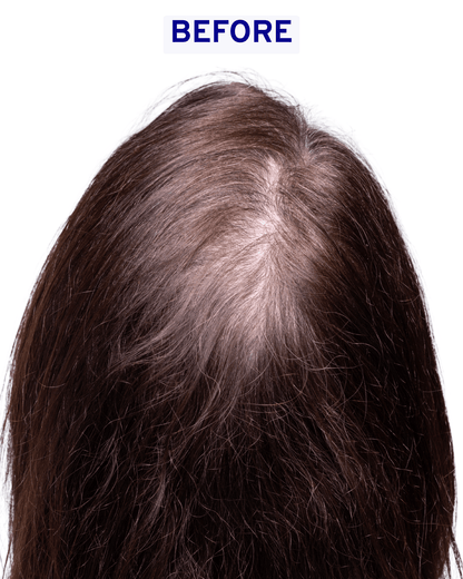 Hair & Scalp Serum