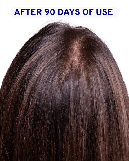 Hair & Scalp Serum